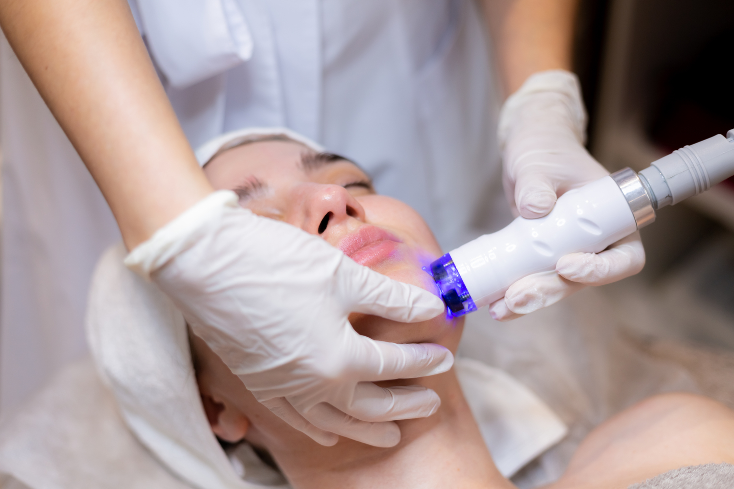Laser Treatments in Aesthetic Dermatology